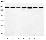 Western blot testing of 1) human MOLT4, 2) human Daudi, 3) human placenta, 4) rat brain, 5) rat C6, 6) mouse brain and 7) mouse NIH 3T3 cell lysate with ROCK1 antibody. Predicted molecular weight ~158 kDa.