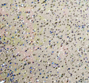 Immunohistochemistry analysis of ROCK1 expression in rat brain tissue. Paraffin-embedded rat brain tissue sections were subjected to heat-mediated antigen retrieval in EDTA buffer (pH 8.0) and incubated with anti-ROCK1 antibody, followed by HRP-conjugated secondary antibody and DAB chromogen development. Brown staining is observed in neuronal cells, consistent with cytoplasmic ROCK1 localization, with hematoxylin nuclear counterstain (blue).