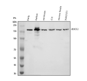 Western blot analysis of ROCK1 expression. Whole cell lysates or tissue lysates from human HeLa cells (lane 1), human Jurkat cells (lane 2), rat brain tissue (lane 3), rat C6 cells (lane 4), mouse brain tissue (lane 5), and mouse NIH/3T3 cells (lane 6) were separated by SDS-PAGE and probed with anti-ROCK1 antibody. A specific immunoreactive band is detected at approximately 158 kDa across the samples, corresponding to ROCK1. This band is consistent with the predicted molecular weight of ROCK1 based on its amino acid sequence.
