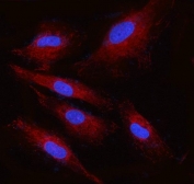 Immunofluorescent staining of FFPE human U-87 MG cells with Ribophorin II antibody (red) and DAPI nuclear stain (blue). HIER: steam section in pH6 citrate buffer for 20 min.