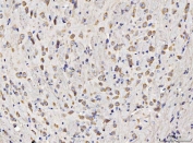 IHC staining of FFPE mouse brain tissue with RPL11 antibody. HIER: boil tissue sections in pH8 EDTA for 20 min and allow to cool before testing.