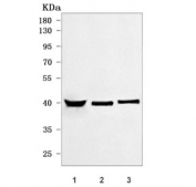 Western blot testing of human 1) PC-3, 2) U-87 MG and 3) HepG2 cell lysate with SCCPDH antibody. Predicted molecular weight ~40 kDa.