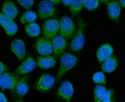 Immunofluorescent staining of FFPE human SiHa cells with SCCPDH antibody (green) and DAPI nuclear stain (blue). HIER: steam section in pH6 citrate buffer for 20 min.