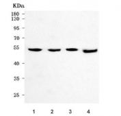 Western blot testing of human 1) HeLa, 2) Jurkat, 3) HL60 and 4) 293T cell lysate with RTCB antibody. Predicted molecular weight ~55 kDa.