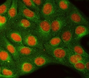 Immunofluorescent staining of FFPE human U-2 OS cells with RTCB antibody (red) and Beta Tubulin mAb (green). HIER: steam section in pH6 citrate buffer for 20 min.