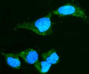 Immunofluorescent staining of FFPE human HepG2 cells with CRYAA antibody (green) and DAPI nuclear stain (blue). HIER: steam section in pH6 citrate buffer for 20 min.
