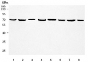 Western blot testing of 1) human U-2 OS, 2) 293T, 3) HaCaT, 4) MCF7, 5) rat brain, 6) rat liver, 7) mouse brain and 8) mouse liver tissue lysate with RTN4R antibody. Predicted molecular weight ~51 kDa but may be observed at higher molecular weights due to glycosylation.
