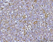 IHC staining of FFPE human tonsil tissue with RUFY4 antibody. HIER: boil tissue sections in pH8 EDTA for 20 min and allow to cool before testing.