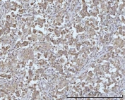IHC staining of FFPE human testicular seminoma tissue with BCAP antibody. HIER: boil tissue sections in pH8 EDTA for 20 min and allow to cool before testing.