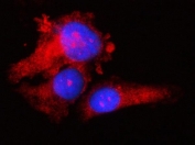 Immunofluorescent staining of FFPE human PC-3 cells with RPS17 antibody (red) and DAPI nuclear stain (blue). HIER: steam section in pH6 citrate buffer for 20 min.