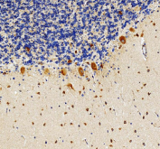 IHC staining of FFPE human cerebellum tissue with RPS17 antibody, HRP-secondary and DAB substrate. HIER: boil tissue sections in pH8 EDTA for 20 min and allow to cool before testing.