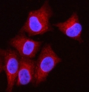 Immunofluorescent staining of FFPE human A549 cells with OLAH antibody (red) and DAPI nuclear stain (blue). HIER: steam section in pH6 citrate buffer for 20 min.