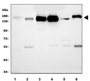 Western bot testing of 1) human ThP-1, 2) human PC-3, 3) monkey kidney, 4) rat kidney, 5) rat liver and 6) mouse kidney tissue lysate with CD13 antibody. Expected molecular weight: 110-150 kDa depending on glycosylation level.