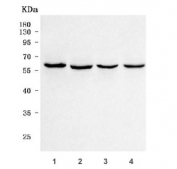 Western blot testing of human 1) MCF7, 2) 293T, 3) Jurkat and 4) MOLT-4 cell lysate with TSEN54 antibody. Predicted molecular weight ~59 kDa.