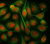 Immunofluorescent staining of FFPE human PC-3 cells with TSEN54 antibody (red) and Beta Tubulin mAb (green). HIER: steam section in pH6 citrate buffer for 20 min.