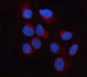 Immunofluorescent staining of FFPE human U-2 OS cells with Dynamin-like 120 kDa protein antibody (red) and DAPI nuclear stain (blue). HIER: steam section in pH6 citrate buffer for 20 min.