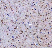 IHC staining of FFPE rat brain tissue with RTF1 antibody. HIER: boil tissue sections in pH8 EDTA for 20 min and allow to cool before testing.