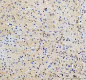IHC staining of FFPE mouse brain tissue with RTF1 antibody. HIER: boil tissue sections in pH8 EDTA for 20 min and allow to cool before testing.