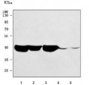 Western blot testing of 1) rat skeletal muscle, 2) rat heart, 3) mouse skeletal muscle, 4) mouse heart and 5) mouse kidney tissue lysate with ST6GalNAc II antibody. Predicted molecular weight ~42 kDa.