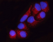 Immunofluorescent staining of FFPE human HeLa cells with SUCLA2 antibody (red) and DAPI nuclear stain (blue). HIER: steam section in pH6 citrate buffer for 20 min.