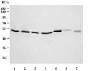 Western blot testing of 1) human HeLa, 2) human 293T, 3) human RT4, 4) human HepG2, 5) rat testis, 6) rat lung and 7) mouse testis tissue lysate with PDXDC1 antibody. Predicted molecular weight: 77-87 kDa and ~48 kDa (multiple isoforms).