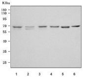 Western blot testing of 1) human HeLa, 2) human Jurkat, 3) human Raji, 4) human K562, 5) rat liver and 6) mouse liver tissue lysate with CDT1 antibody. Predicted molecular weight ~60 kDa, commonly observed at 60-70 kDa.