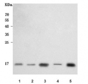 Western blot testing of 1) human HeLa, 2) human U-251, 3) human SH-SY5Y, 4) rat PC-12 and 5) mouse Neuro-2a cell lysate with OMP antibody. Predicted molecular weight ~19 kDa. 