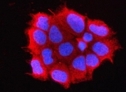 Immunofluorescent staining of FFPE human Caco-2 cells with OMP antibody (red) and DAPI nuclear stain (blue). HIER: steam section in pH6 citrate buffer for 20 min.