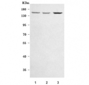 Western blot testing of human 1) HeLa, 2) PC-3 and 3) SH-SY5Y cell lysate with RREB1 antibody. Predicted molecular weight: 153-188 (multiple isoforms) with two smaller isoforms.