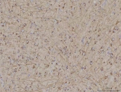 IHC staining of FFPE mouse brain tissue with TMEM87A antibody. HIER: boil tissue sections in pH8 EDTA for 20 min and allow to cool before testing.