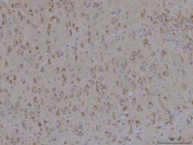 IHC staining of FFPE rat brain tissue with TMEM87A antibody. HIER: boil tissue sections in pH8 EDTA for 20 min and allow to cool before testing.