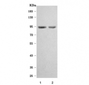 Western blot testing of 1) rat brain and 2) mouse brain tissue lysate with TMEM132B antibody. Predicted molecular weight ~95 kDa.
