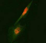 Immunofluorescent staining of FFPE human U-87 MG cells with RUFY2 antibody (red) and Beta Tubulin mAb (green). HIER: steam section in pH6 citrate buffer for 20 min.