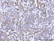 IHC staining of FFPE human testicular seminoma tissue with OSGIN1 antibody. HIER: boil tissue sections in pH8 EDTA for 20 min and allow to cool before testing.
