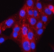 Immunofluorescent staining of FFPE human U-2 OS cells with PACSIN2 antibody (red) and DAPI nuclear stain (blue). HIER: steam section in pH6 citrate buffer for 20 min.