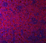 Immunofluorescent staining of FFPE human testicular cancer tissue with PACSIN2 antibody (red) and DAPI nuclear stain (blue). HIER: steam section in pH8 EDTA buffer for 20 min.