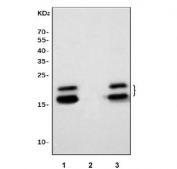 Western blot testing of 1) rat eye, 2) rat C6 and 3) mouse eye tissue lysate with CRYAA antibody. Expected molecular weight: 20-23 kDa.