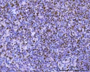 IHC staining of FFPE mouse spleen tissue with PAX5 antibody. HIER: boil tissue sections in pH8 EDTA for 20 min and allow to cool before testing.