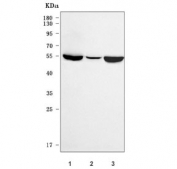Western blot testing of human 1) HeLa, 2) human Jurkat and 3) mouse testis tissue lysate with OXCT2 antibody. Predicted molecular weight ~56 kDa.