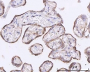 IHC staining of FFPE human placental tissue with OXCT2 antibody. HIER: boil tissue sections in pH8 EDTA for 20 min and allow to cool before testing.