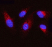 Immunofluorescent staining of FFPE human PC-3 cells with OXSM antibody (red) and DAPI nuclear stain (blue). HIER: steam section in pH6 citrate buffer for 20 min.