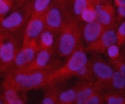 Immunofluorescent staining of FFPE human HeLa cells with PGAM1 antibody (red) and DAPI nuclear stain (blue). HIER: steam section in pH6 citrate buffer for 20 min.