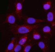 Immunofluorescent staining of FFPE human U-2 OS cells with Profilin 3 antibody (red) and DAPI nuclear stain (blue). HIER: steam section in pH6 citrate buffer for 20 min.