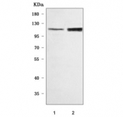 Western blot testing of human 1) 293T and 2) HEL cell lysate with ORP8 antibody. Predicted molecular weight ~101 kDa.