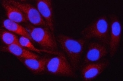 Immunofluorescent staining of FFPE human HeLa cells with ORP8 antibody (red) and DAPI nuclear stain (blue). HIER: steam section in pH6 citrate buffer for 20 min.