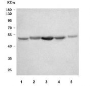 Western blot testing of 1) human HepG2, 2) human HCCT, 3) human HCCP, 4) rat liver and 5) mouse liver tissue lysate with OIT3 antibody. Predicted molecular weight ~35/60 kDa (two isoforms) but may be seen at higher molecular weights due to glycosylation.