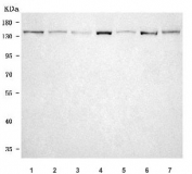 Western blot testing of 1) human HepG2, 2) human T-47D, 3) monkey COS-7, 4) rat liver, 5) rat brain, 6) mouse liver and 7) mouse brain tissue lysate with OPLAH antibody. Predicted molecular weight ~137 kDa.