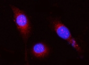 Immunofluorescent staining of FFPE human PC-3 cells with OPLAH antibody (red) and DAPI nuclear stain (blue). HIER: steam section in pH6 citrate buffer for 20 min.