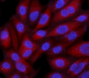 Immunofluorescent staining of FFPE human PC-3 cells with SMG9 antibody (red) and DAPI nuclear stain (blue). HIER: steam section in pH6 citrate buffer for 20 min.