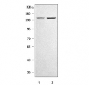 Western blot testing of human 1) MCF7 and 2) HepG2 cell lysate with SULF2 antibody. Predicted molecular weight ~100 kDa but may be observed at higher molecular weights due to glycosylation.